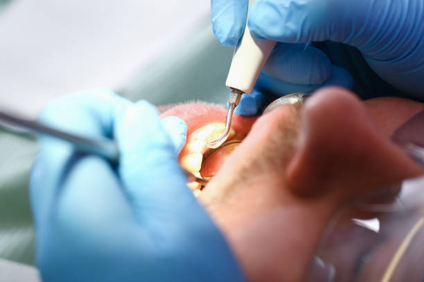 Urgent Tooth Repair in AZ