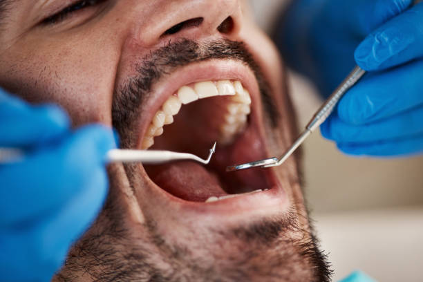 Best Broken Tooth Emergency  in Claypool, AZ
